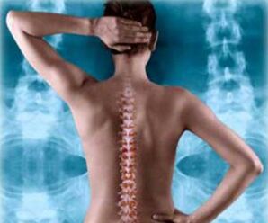 арткы омуртканы иллюстрация