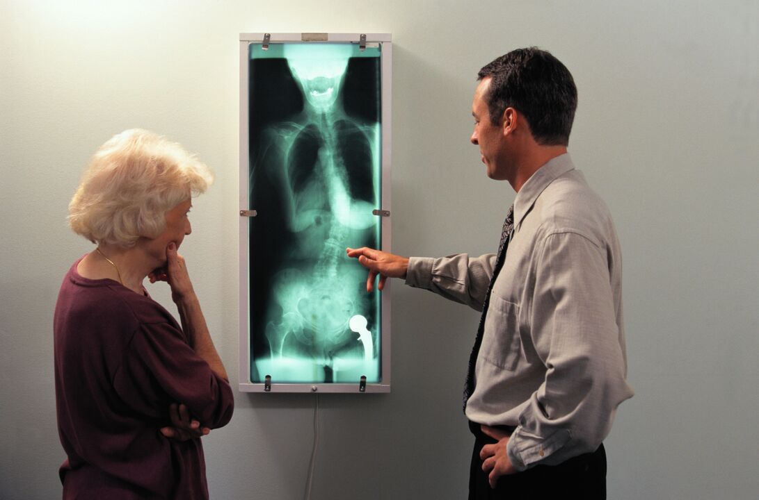 жамбаш муунунун оорушу үчүн рентген диагностикасы