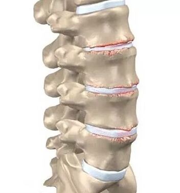 OsteOnochonRos